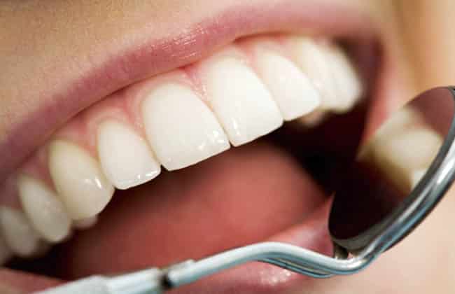 Oral Hygiene